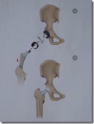 Hüftgelenk (9)